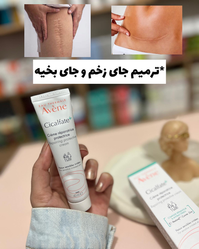کرم ترمیم کننده اون مدل سیکالفیت حجم 100 میلی لیتر(ارسال رایگان)