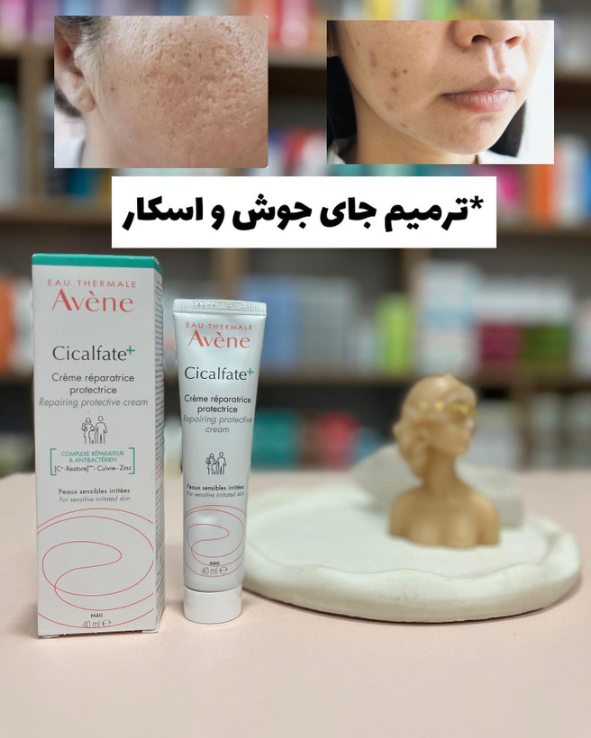 کرم ترمیم کننده اون مدل سیکالفیت حجم 100 میلی لیتر(ارسال رایگان)