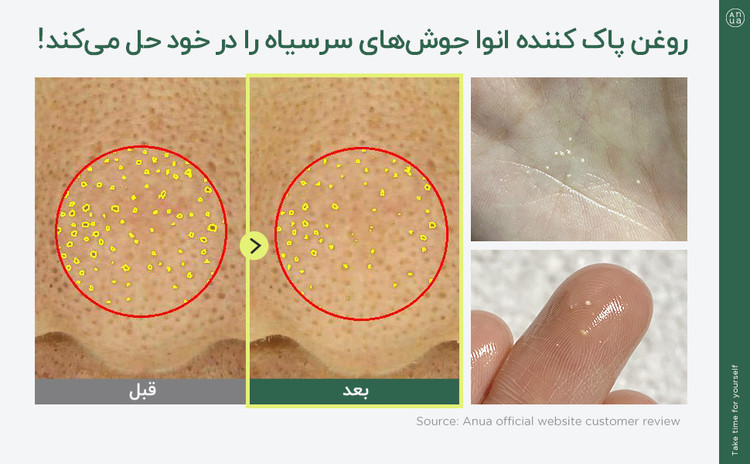 روغن پاک کننده ۲۰۰ml صورت انوا(ارسال رایگان)